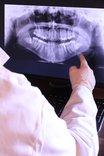 Best Emergency Gum Treatment in Kirkland, WA